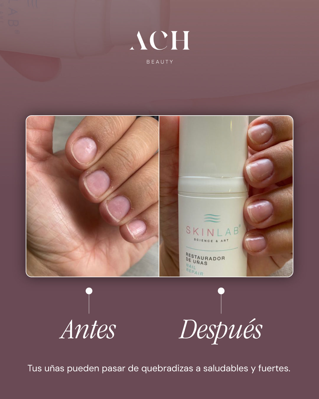 Endurecedor de Uñas SKINLAB 13 ml