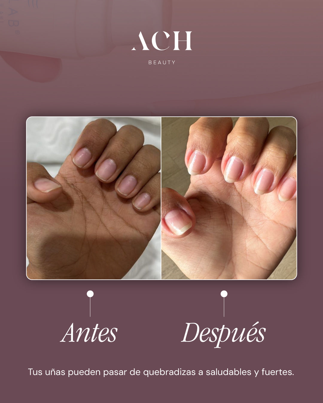 Endurecedor de Uñas SKINLAB 13 ml