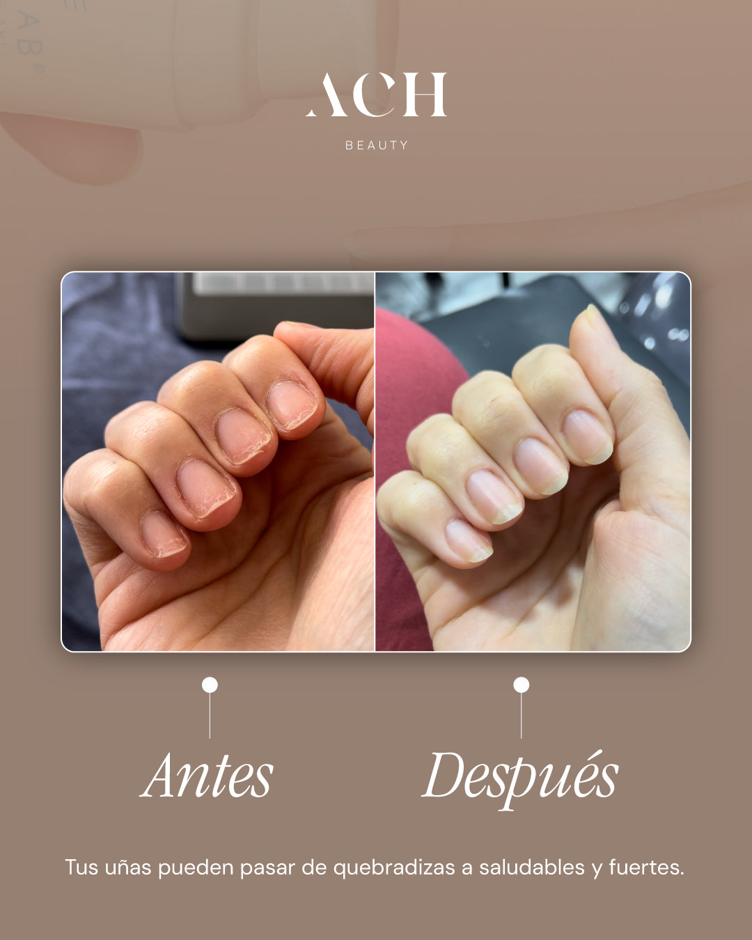 Endurecedor de Uñas SKINLAB 13 ml