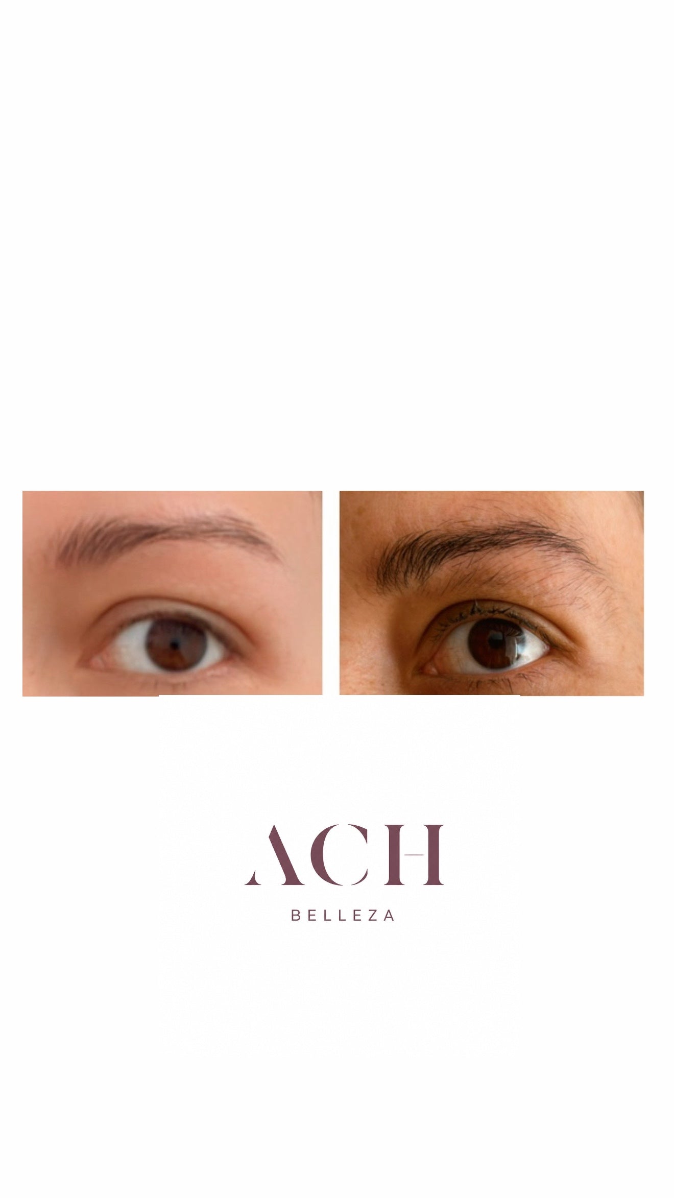 Kit de cejas perfectas Sérum + Dermaroller