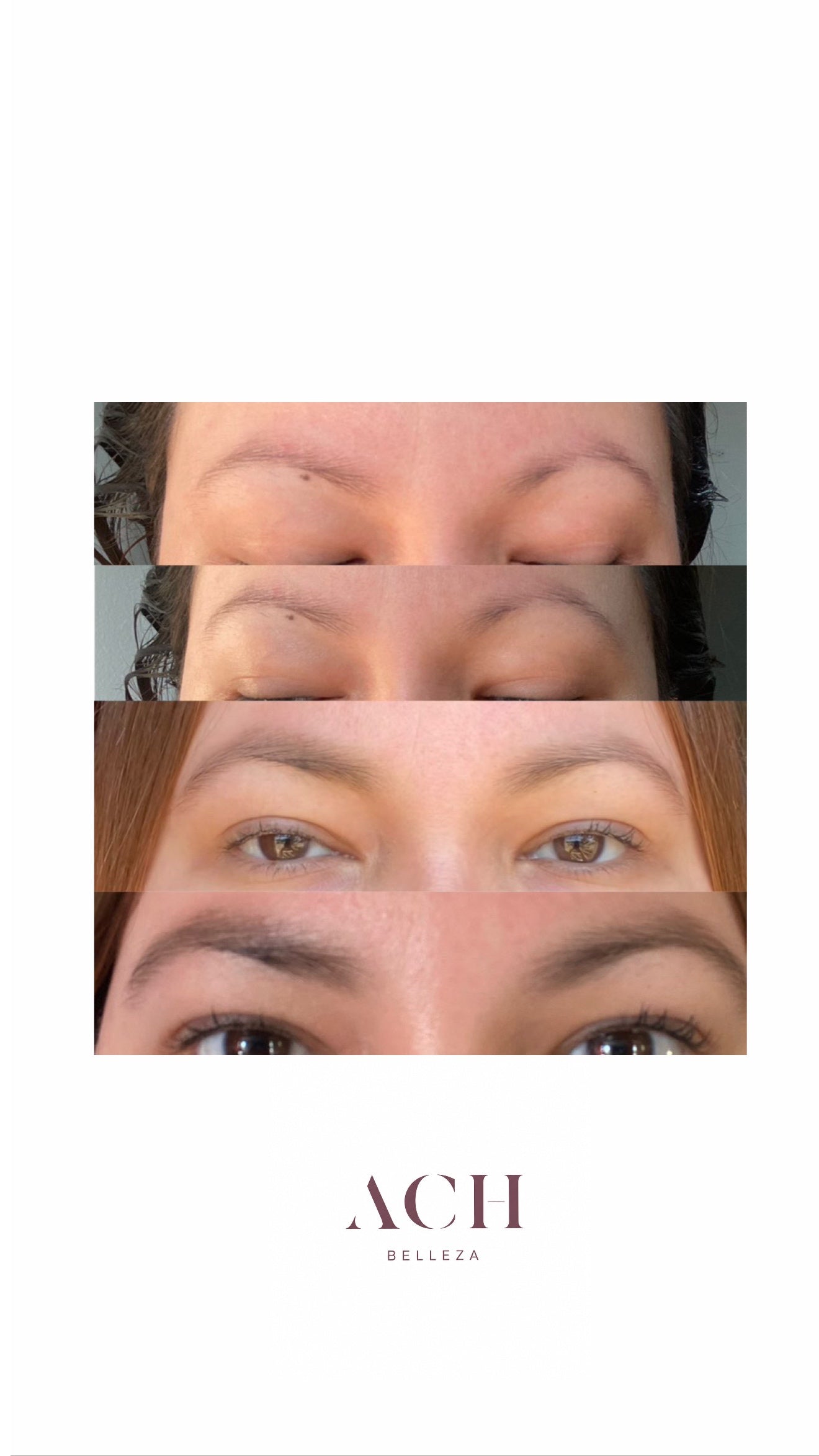 Kit de cejas perfectas Sérum + Dermaroller